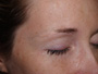 before and after eyebrows procedure in New York City