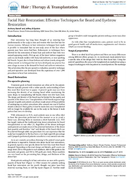 Facial Hair Restoration: Effective Techniques For Beard and Eyebrow Restoration